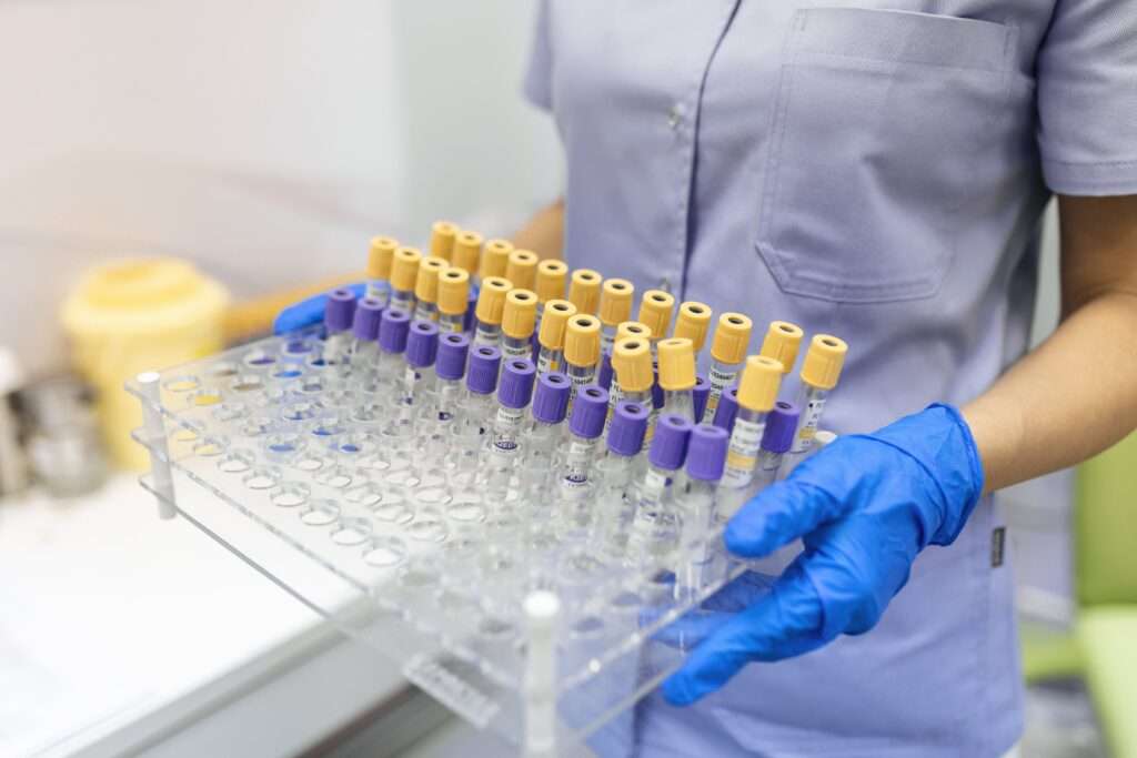 Immunology Cyprus Lab
